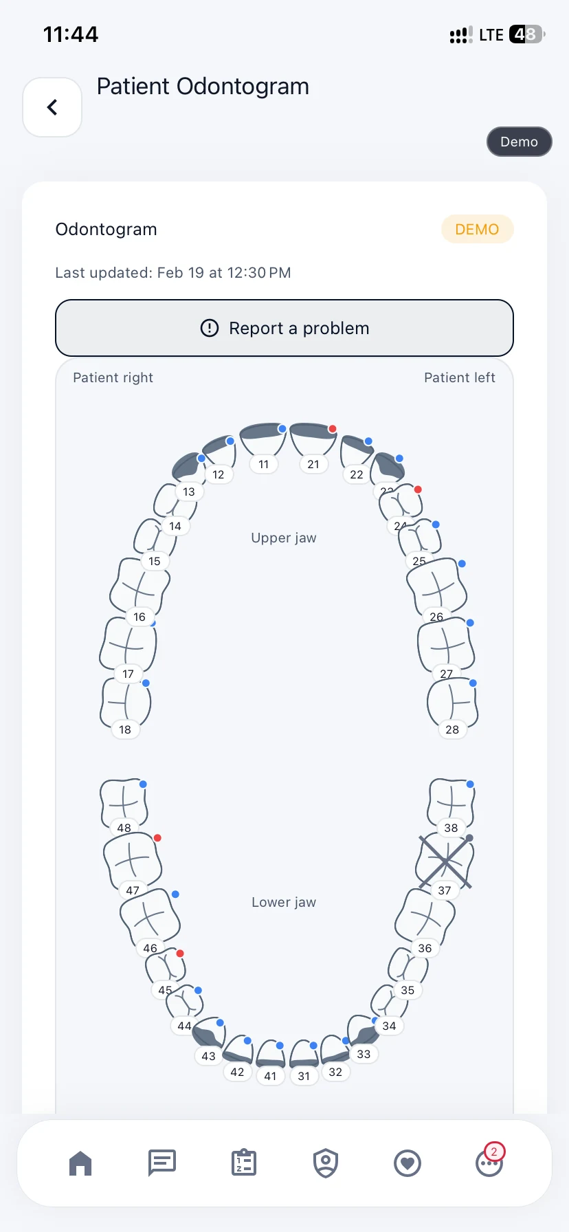 Sarop Life patient odontogram with fictional demo dental findings